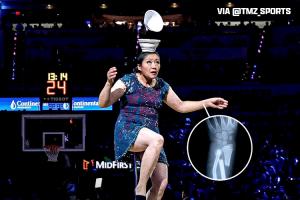 ??頂碗大媽聲明：獨輪車踏板運輸受損 左手腕嚴(yán)重骨折??