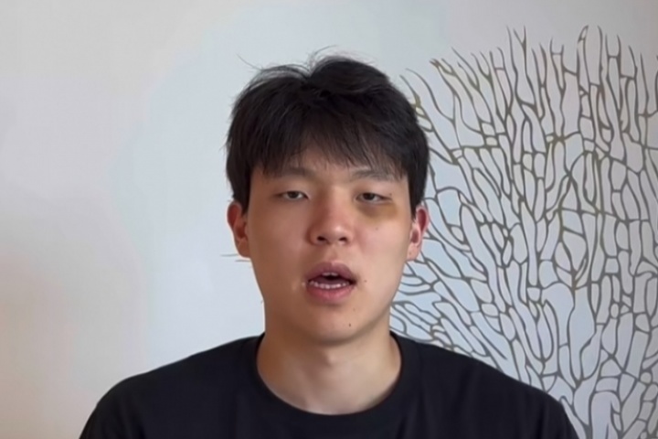 ??楊瀚森腫著熊貓眼回應東契奇：謝謝關注 等你的手機號 賽場見